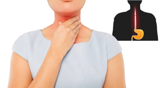 trào ngược dạ dày thực quản